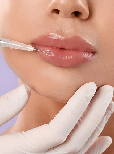 Aumento de labios en manizales