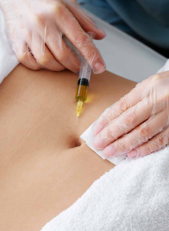 Mesoterapia en Manizales