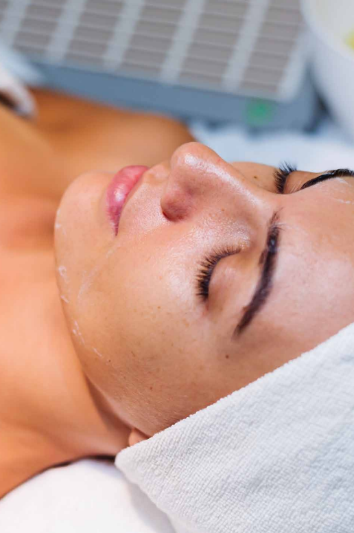 peeling quimico en manizales